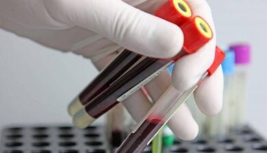 Cómo tomar pruebas de parásitos en el cuerpo