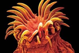 Parásitos trematodos en humanos